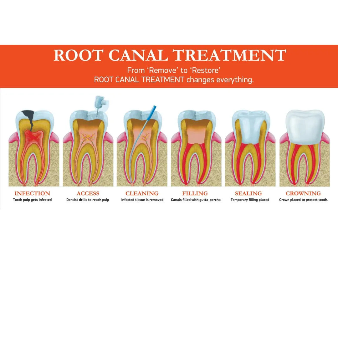 SafeEndo BioActive 3D mdental