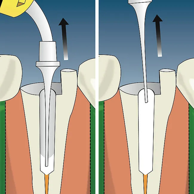 SafeEndo CalciCure mdental