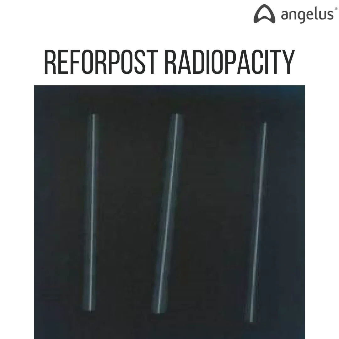 Angelus Reforpost Fiber Glass - Intraradicular Post mdental