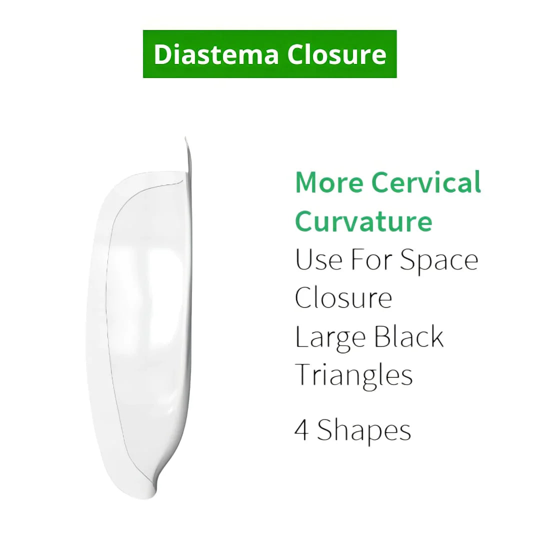 Bioclear Anterior Matrix – Diastema Closure Series mdental