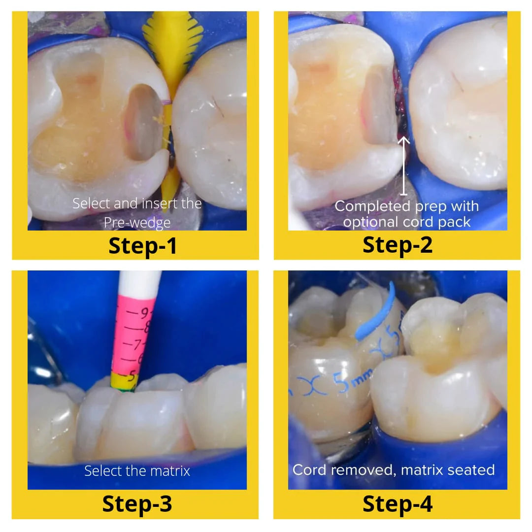 Bioclear Evolve Matrices Mini Kit mdental