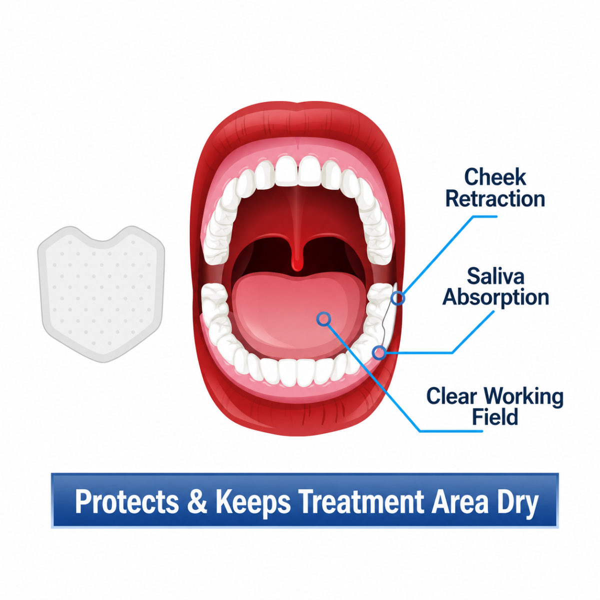Capri Cheek Guard | Dental Cheek Retractor | Autoclavable Clear Plastic | Adult & Child Sizes