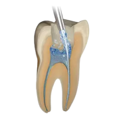 SafeEndo Smart Prep Liquid mdental