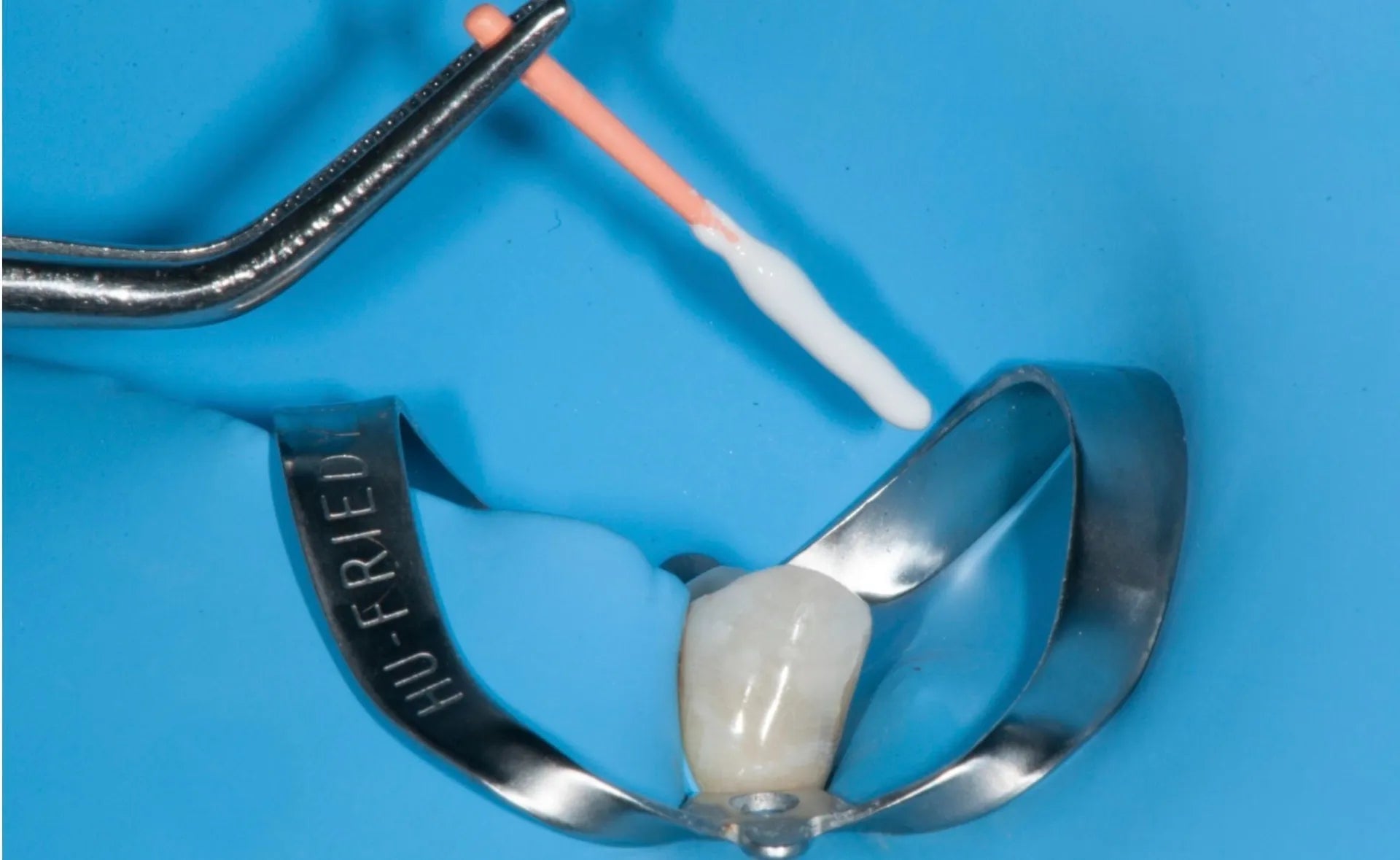 SafeEndo EpoxySeal mdental