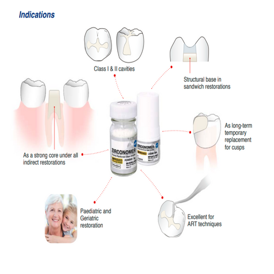 Shofu Zirconomer Improved | Zirconia Reinforced Glass Ionomer Restorative Cement | High Strength GIC